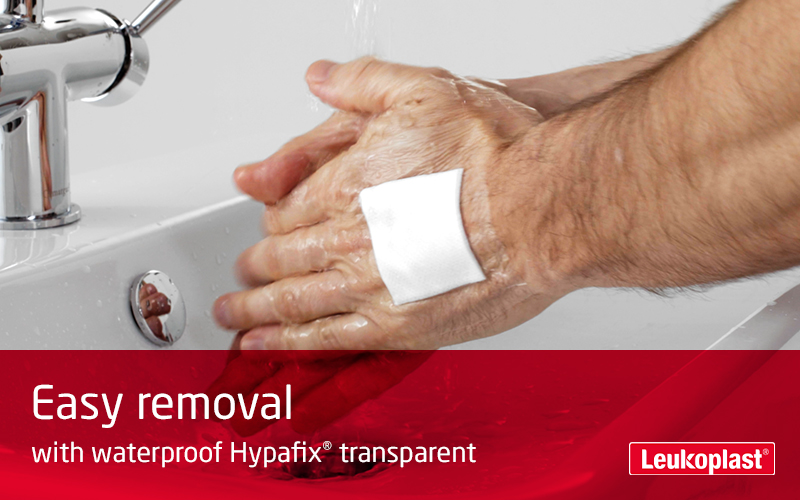 This video demonstrates that Hypafix transparent is a waterproof wound cover for showering: We see a male patient washing his hands with a bandage on the back of his hand, and then the skin-friendly bandage being easily removed by an HCP. This video demonstrates that Hypafix transparent is a waterproof wound cover for showering: We see a male patient washing his hands with a bandage on the back of his hand, and then the skin-friendly bandage being easily removed by an HCP.